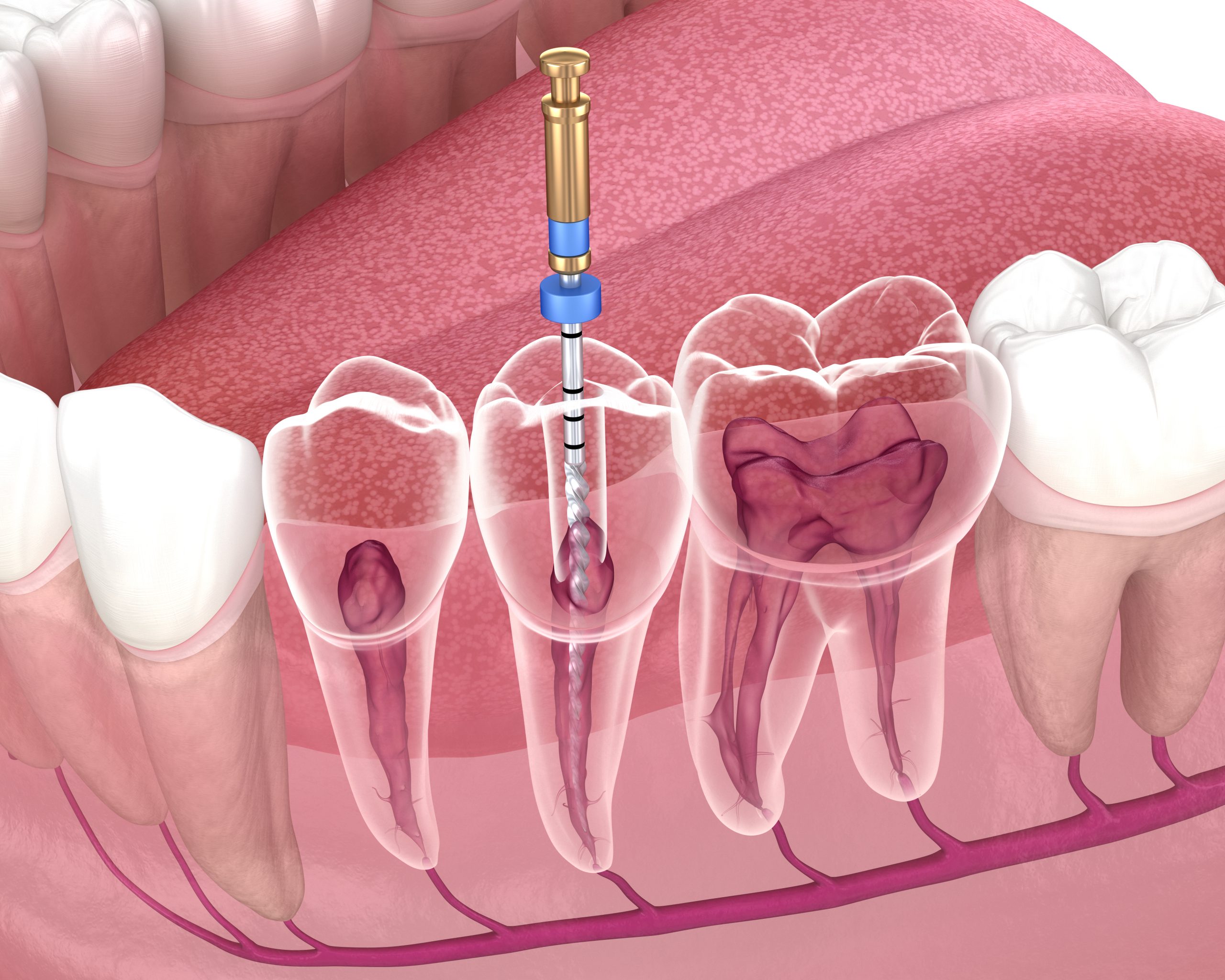What is Endodontics? Understanding the Basics